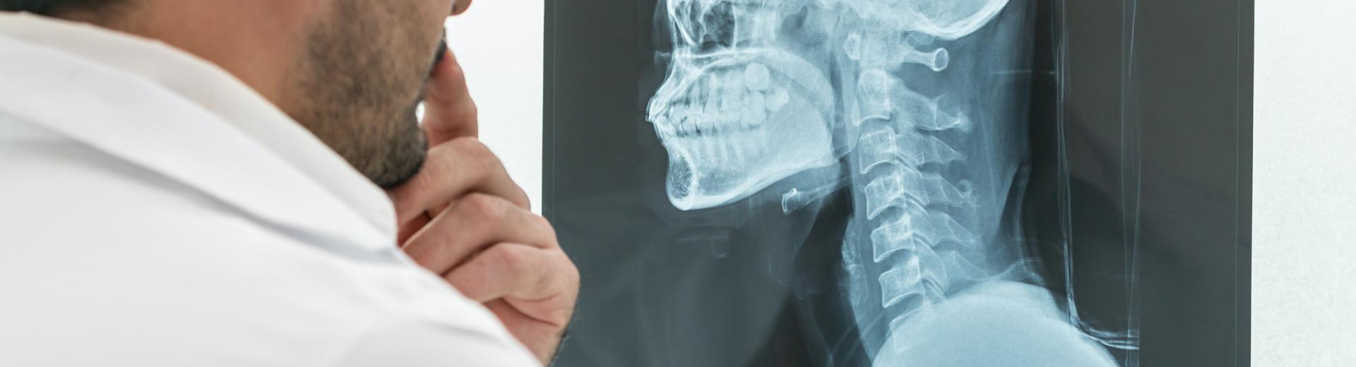 X-Ray